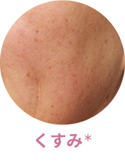 くすみ
