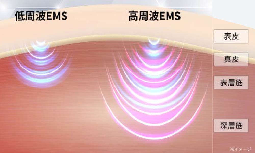 低周波～高周波のEMSイメージ