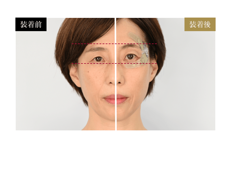 装着時の引き上がり比較/写真:装着前・装着後